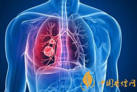 長期吸二手煙的危害 容易誘發(fā)這七種健康問題