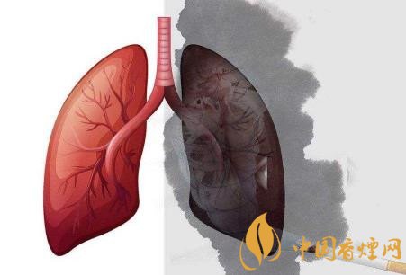 吸煙是怎樣危害肺部健康 吸煙的常見(jiàn)五大危害介紹